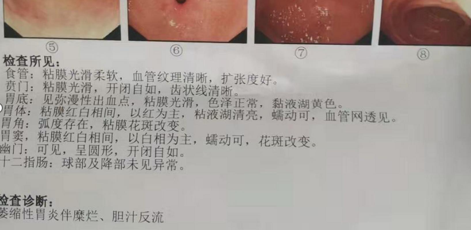 澳門6合開獎結(jié)果和戀愛后莫名口臭胃痛與談戀愛口臭